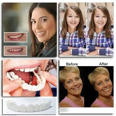💝Last day discount-50%Off🔥Latest👨‍⚕Adjustable Snap-On Dentures😁